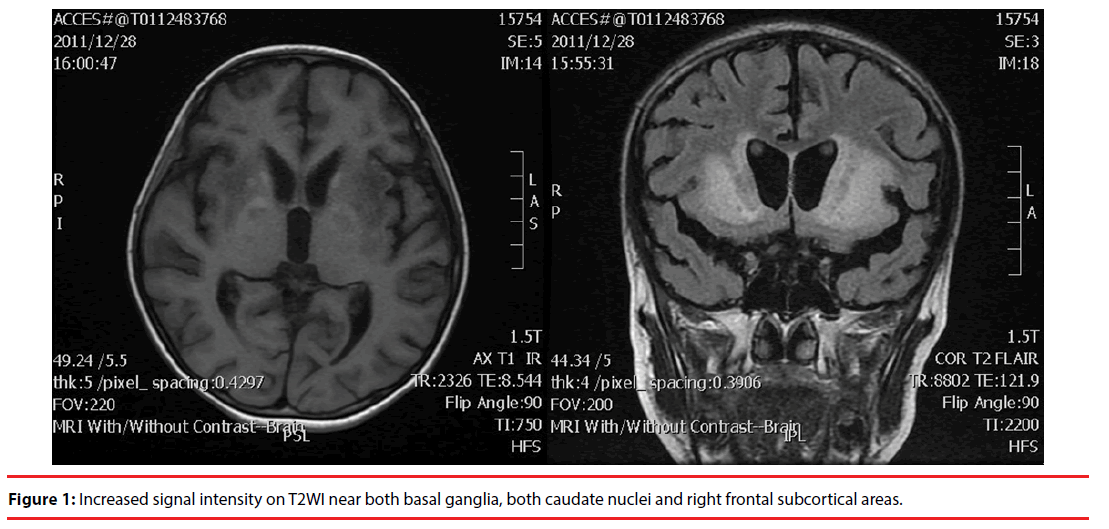 neuropsychiatry-subcortical-areas