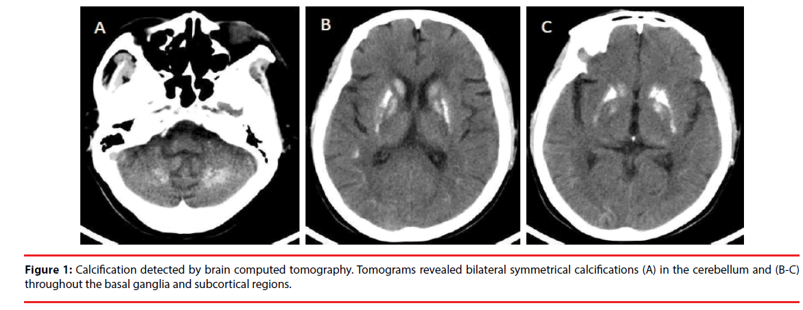 neuropsychiatry-subcortical-regions