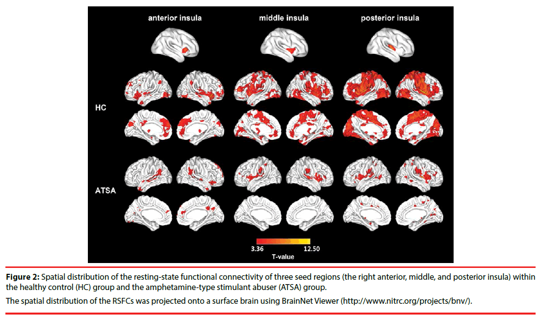 neuropsychiatry-surface-brain