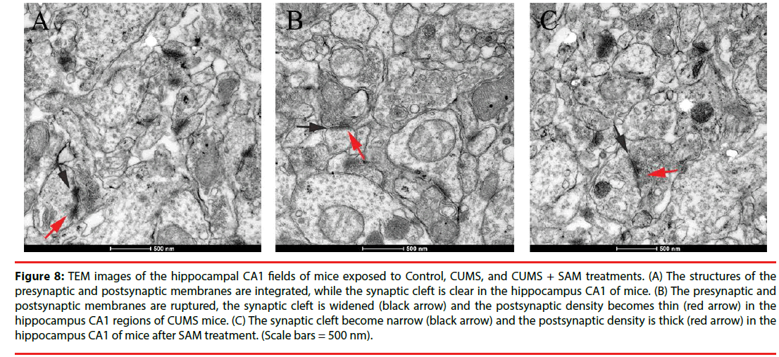 neuropsychiatry-synaptic-cleft