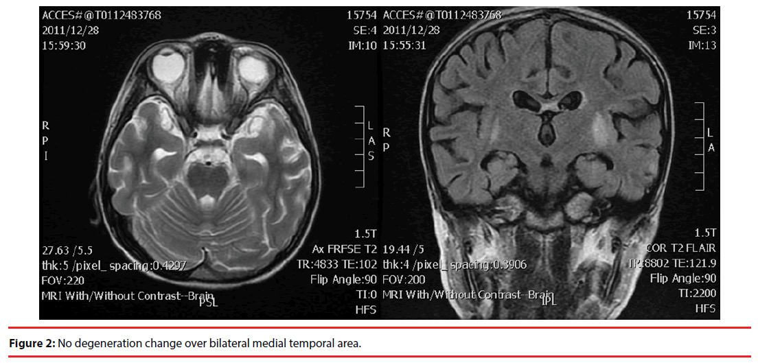 neuropsychiatry-temporal-area