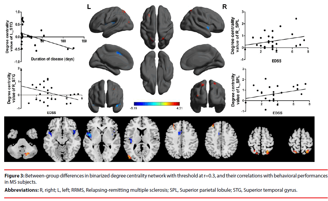 neuropsychiatry-temporal-gyrus