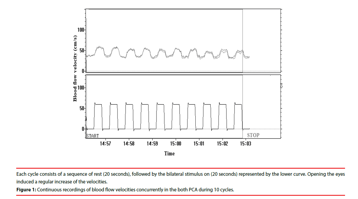 neuropsychiatry-velocities-concurrently