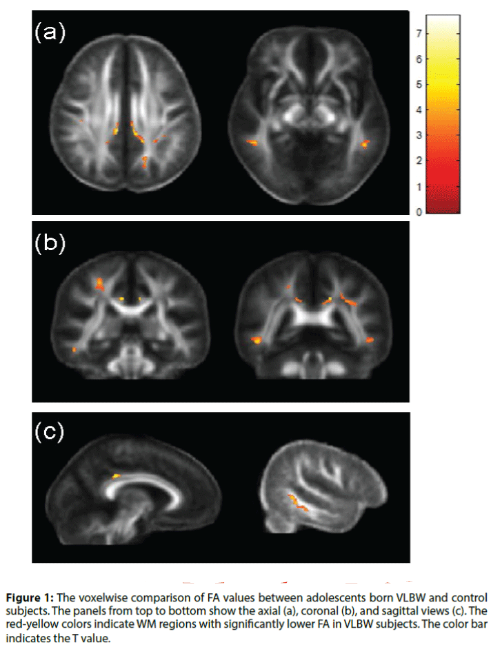 neuropsychiatry-voxelwise-comparison