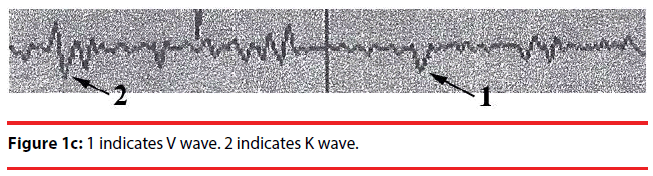 neuropsychiatry-wave