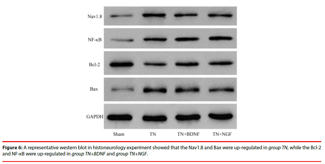 neuropsychiatry-western-blot