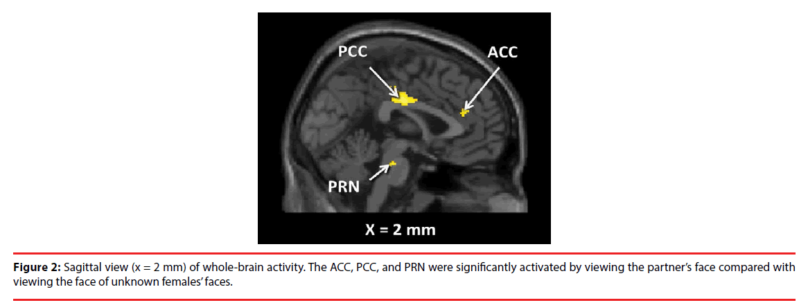 neuropsychiatry-whole-brain