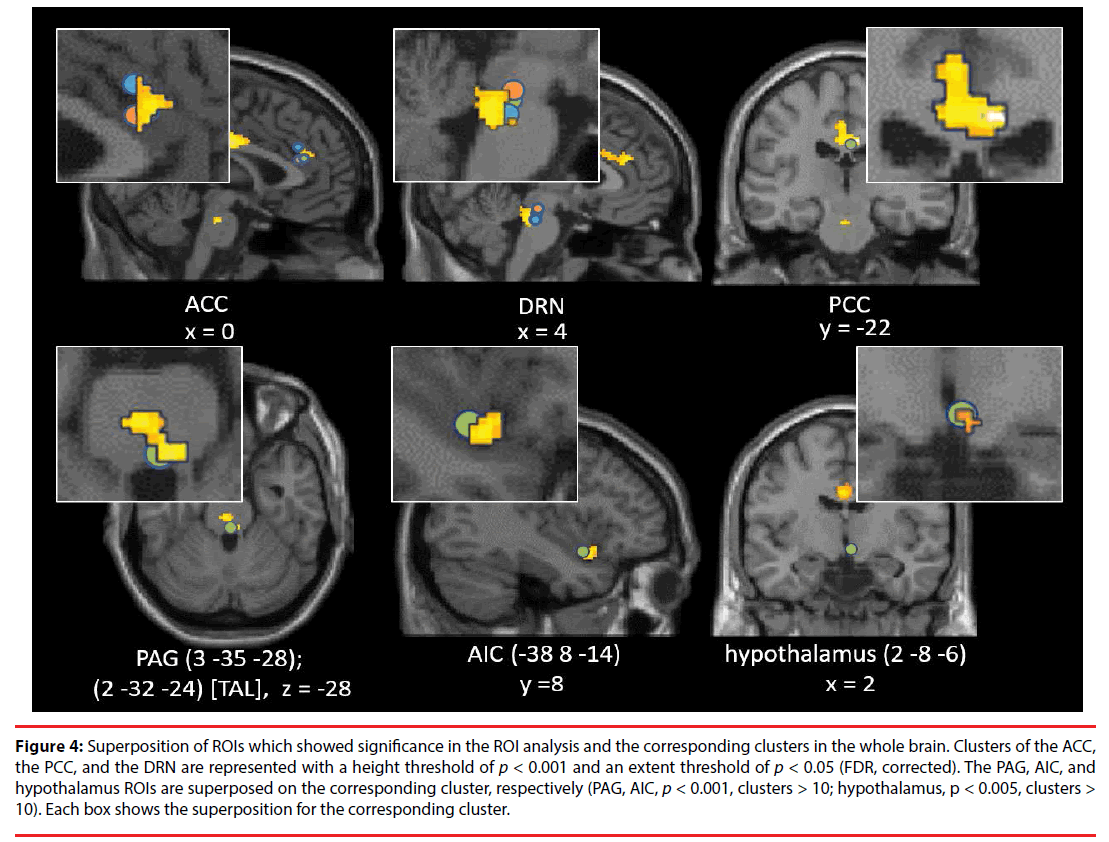 neuropsychiatry-whole-brain